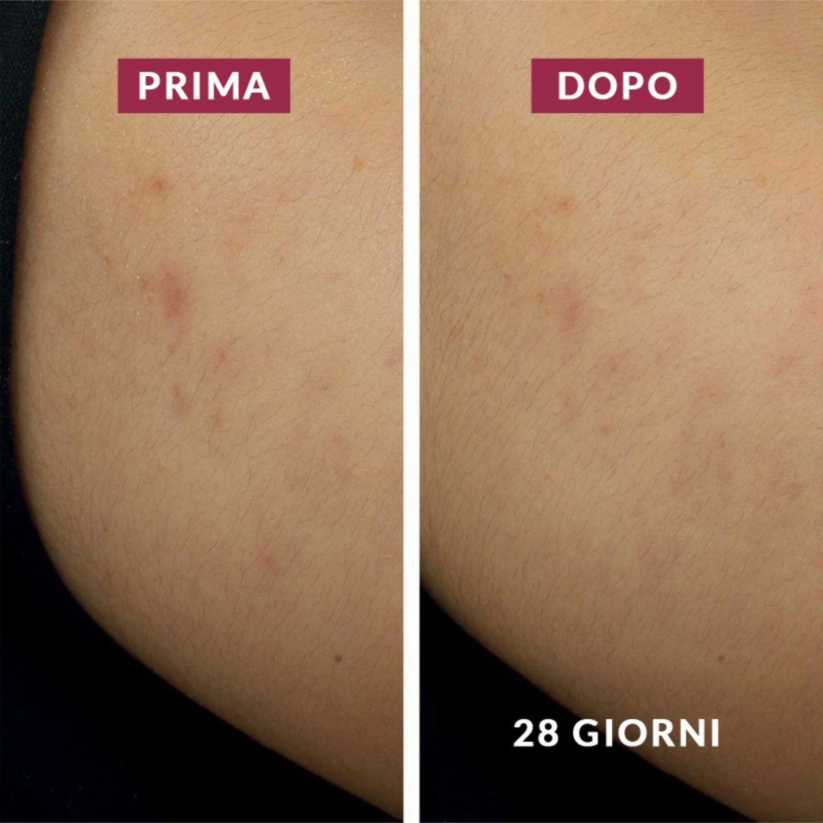 Crema Notte Anti-Macchie