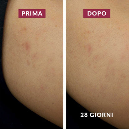 Crema Notte Anti-Macchie